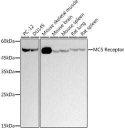 ABclonal Technology&nbsp;MC5 Receptor Rabbit mAb
