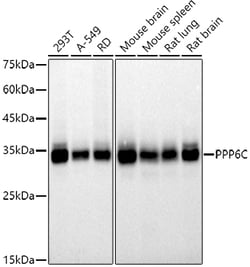 ABclonal Technology&nbsp;PPP6C Rabbit mAb