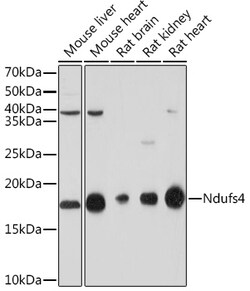 ABclonal Technology&nbsp;NDUFS4 Rabbit mAb