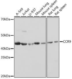 ABclonal Technology&nbsp;CCR9 Rabbit mAb