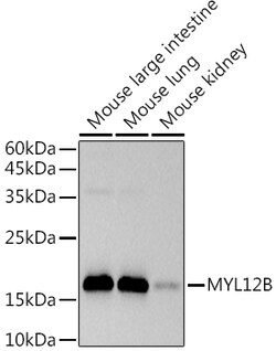 ABclonal Technology&nbsp;MYL12B Rabbit mAb