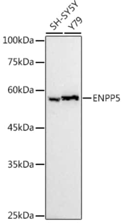 ABclonal Technology&nbsp;ENPP5 Rabbit mAb