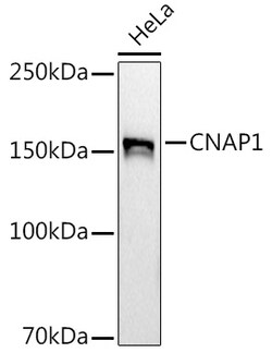 ABclonal Technology&nbsp;CNAP1 Rabbit mAb