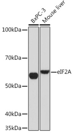 ABclonal Technology&nbsp;eIF2A Rabbit mAb