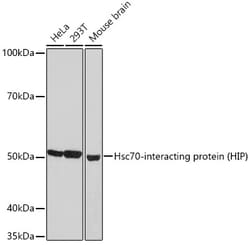 ABclonal Technology&nbsp;Hsc70-interacting protein (HIP) Rabbit mAb