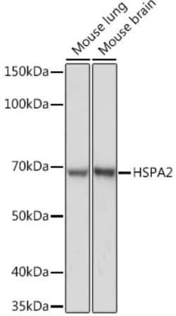 ABclonal Technology&nbsp;HSPA2 Rabbit mAb