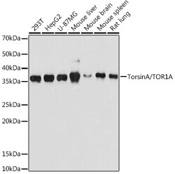 ABclonal Technology&nbsp;TorsinA/TOR1A Rabbit mAb