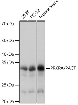 ABclonal Technology&nbsp;PRKRA/PACT Rabbit mAb