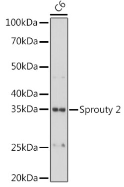 ABclonal Technology&nbsp;Sprouty 2 Rabbit mAb