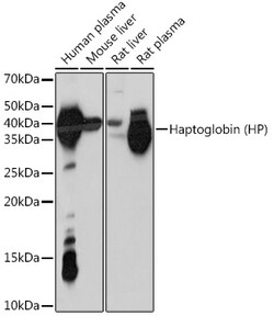 ABclonal Technology&nbsp;Haptoglobin (HP) Rabbit mAb