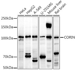 ABclonal Technology&nbsp;CORIN Rabbit pAb