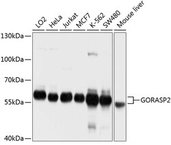 ABclonal Technology&nbsp;GORASP2 Rabbit pAb