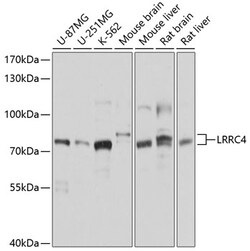 ABclonal Technology&nbsp;LRRC4 Rabbit pAb
