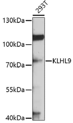 ABclonal Technology&nbsp;KLHL9 Rabbit pAb