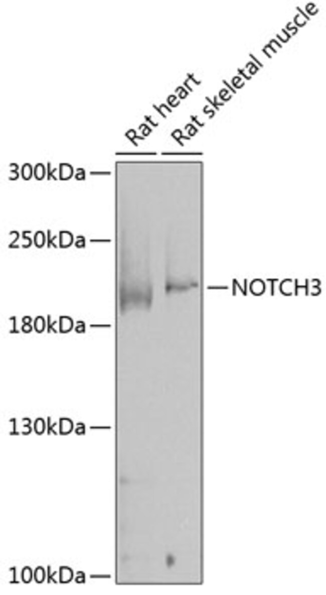 ABclonal Technology NOTCH3 Rabbit pAb, Quantity: Each of 1 | Fisher ...