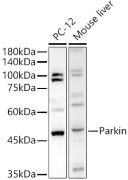 ABclonal Technology&nbsp;Human Parkin Rabbit pAb