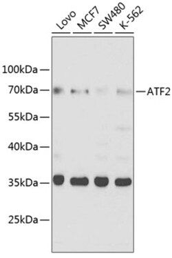 ABclonal Technology&nbsp;ATF2 Rabbit pAb