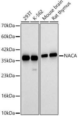 ABclonal Technology&nbsp;NACA Rabbit pAb