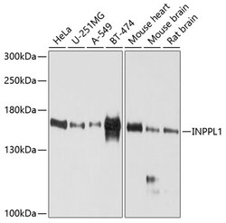 ABclonal Technology&nbsp;INPPL1 Rabbit pAb