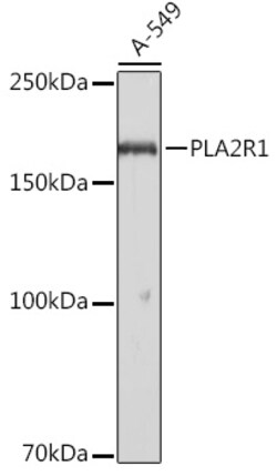 ABclonal Technology&nbsp;PLA2R1 Rabbit pAb