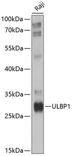 ABclonal Technology&nbsp;ULBP1 Rabbit pAb