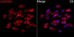 ABclonal Technology&nbsp;CACNG1 Rabbit pAb