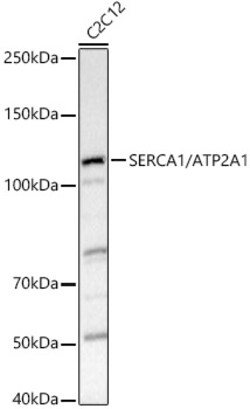 ABclonal Technology&nbsp;SERCA1/ATP2A1 Rabbit pAb