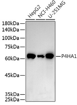 ABclonal Technology&nbsp;P4HA1 Rabbit pAb