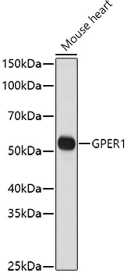 ABclonal Technology&nbsp;GPER1 Rabbit pAb