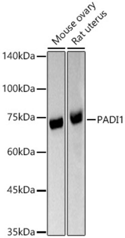 ABclonal Technology&nbsp;PADI1 Rabbit pAb