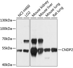 ABclonal Technology&nbsp;CNDP2 Rabbit pAb