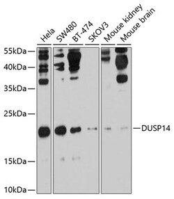 ABclonal Technology&nbsp;DUSP14 Rabbit pAb