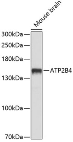 ABclonal Technology&nbsp;ATP2B4 Rabbit pAb