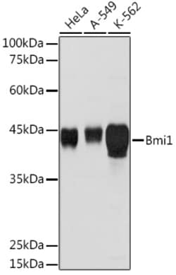 ABclonal Technology&nbsp;Bmi1 Rabbit pAb