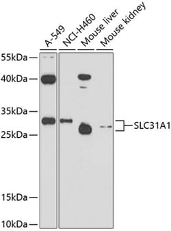 ABclonal Technology&nbsp;SLC31A1 Rabbit pAb