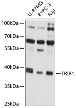 ABclonal Technology&nbsp;TRIB1 Rabbit pAb