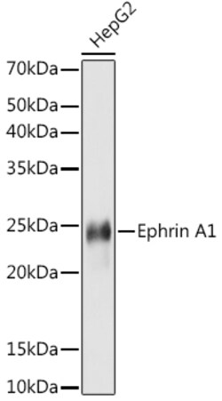 ABclonal Technology&nbsp;Ephrin A1 Rabbit mAb