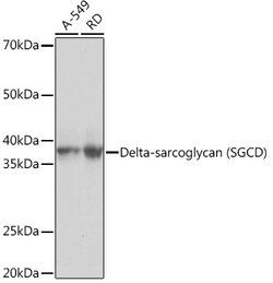 ABclonal Technology&nbsp;Delta-sarcoglycan (SGCD) Rabbit mAb
