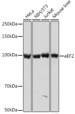 ABclonal Technology&nbsp;eEF2 Rabbit mAb