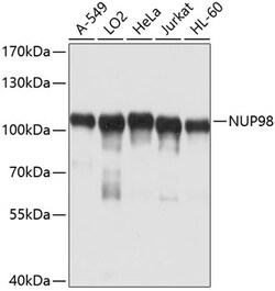 ABclonal Technology&nbsp;NUP98 Rabbit pAb