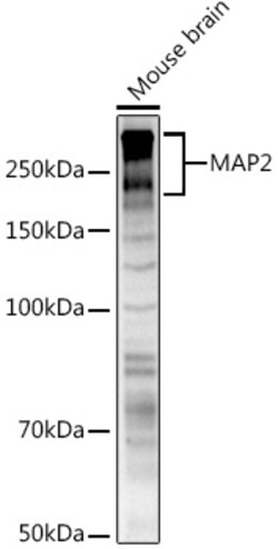 ABclonal Technology&nbsp;MAP2 Rabbit pAb