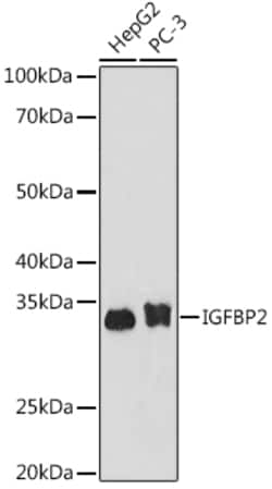 ABclonal Technology&nbsp;IGFBP2 Rabbit mAb