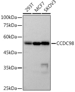 ABclonal Technology&nbsp;CCDC98 Rabbit mAb