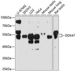 ABclonal Technology&nbsp;DDX47 Rabbit pAb