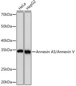 ABclonal Technology&nbsp;Annexin A5/Annexin V Rabbit mAb