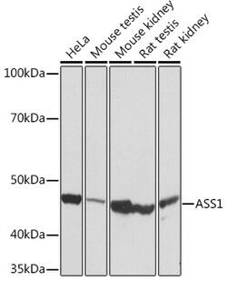 ABclonal Technology&nbsp;ASS1 Rabbit mAb