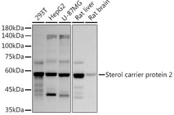 ABclonal Technology&nbsp;Sterol carrier protein 2 Rabbit mAb