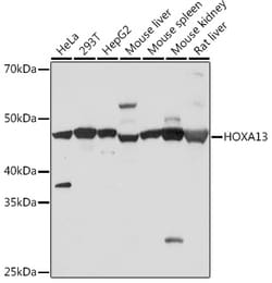ABclonal Technology&nbsp;HOXA13 Rabbit mAb