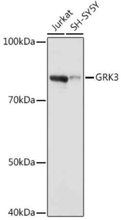 ABclonal Technology&nbsp;GRK3 Rabbit mAb