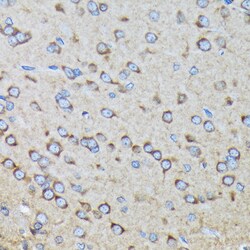 ABclonal Technology&nbsp;RALBP1 Rabbit mAb